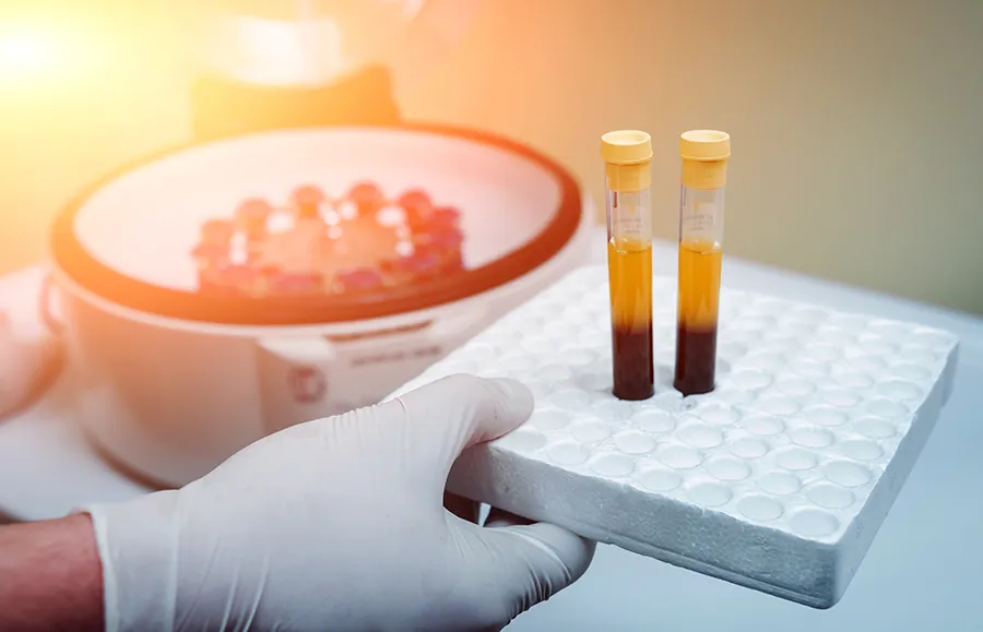 PRP Treatments - find doctors